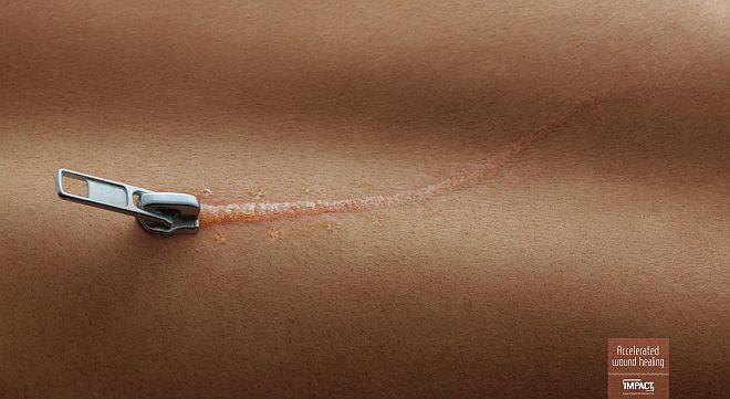 Impact - McCann