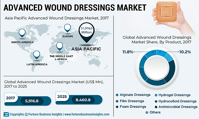 Modern kötszerek piaca