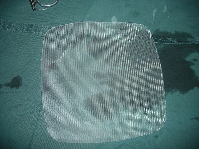 Polipropilén háló