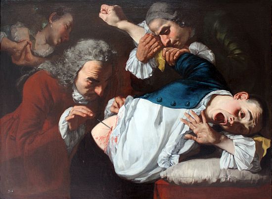 Gaspare Traversi (1720-1780) festménye: Az operáció (A seb)