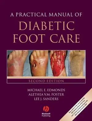 Book: A Practical Manual of Diabetic Foot Care, 2nd Edition