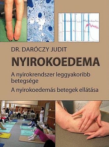 Nyirokoedema